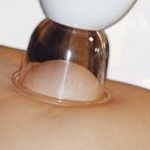 Вакуумный массаж в домашних условиях