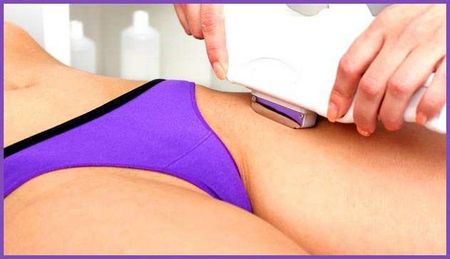 Что такое элос эпиляция?