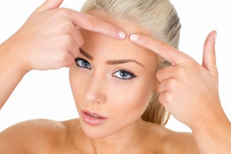 Как правильно выдавливать прыщи