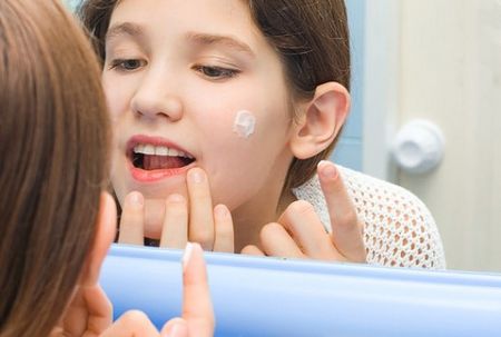 Простые средства от прыщей