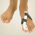 Шишка на стопе – что это такое и как с этим бороться