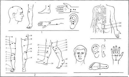 Акупунктурный массаж: что это, видео, техника Акупунктурный массаж: что это, видео, техника