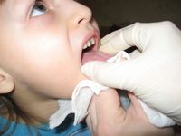 Массаж при дизартрии