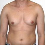 Как уменьшить грудь: диета и упражнения