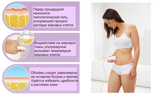 Ультразвуковая кавитация - что это такое