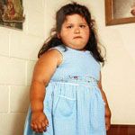 Причины ожирения у детей следует искать в семье