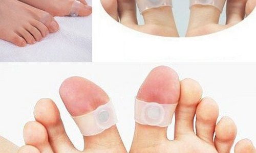 Кольца на пальцы ног для похудения: отзывы и особенности